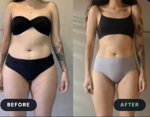 Linda before and after transformation